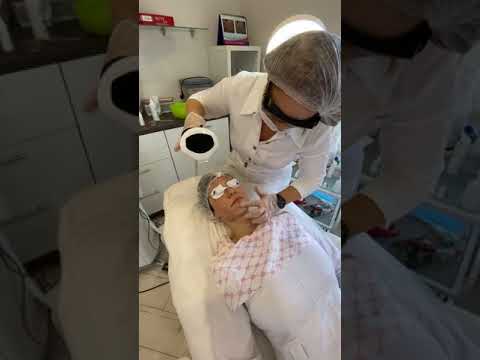 Видео: Фотоомоложение на Lumecca Inmode