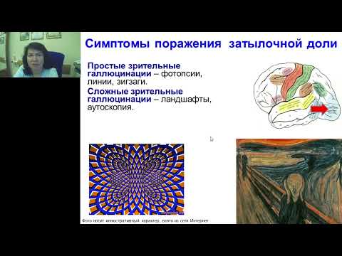 Видео: Усова Н.Н. Симптомы поражения затылочной доли