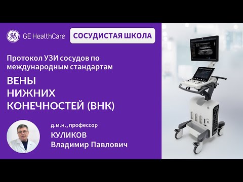 Видео: Сосудистая школа GE Healthcare. Вены нижних конечностей (ВНК). Сессия №2