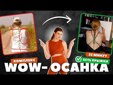 Видео: Эти упражнения исправили мне осанку. Присоединяйся!