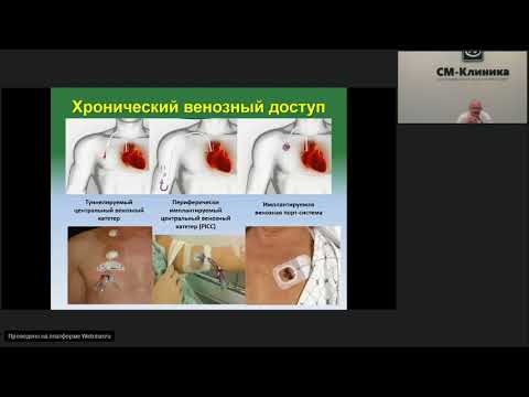 Видео: Запись вебинара «Имплантируемые порт системы» - Лёвин В.В. (17.07.2018)