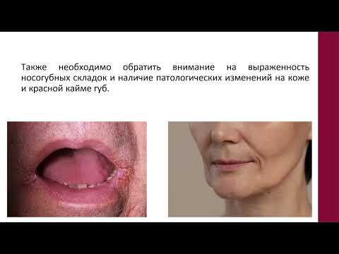 Видео: Методы обследования в стоматологии ортопедической. ФУВ. Лекция 1