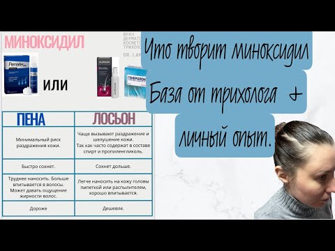 Видео: Миноксидил при АГА. Опасно или полезно. База от врача трихолога. Личный опыт.