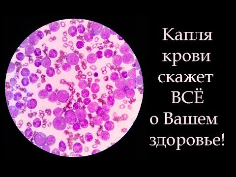 Видео: H2Magic: -ОВП ВОДЫ наглядно по капле крови Ольга Ивановна Шишова (врач восстановительной медицины)