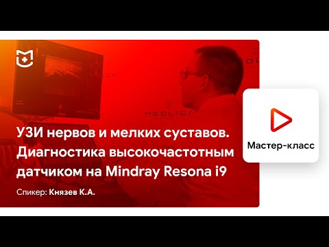 Видео: УЗИ нервов и мелких суставов. Диагностика высокочастотным датчиком на Mindray Resona i9