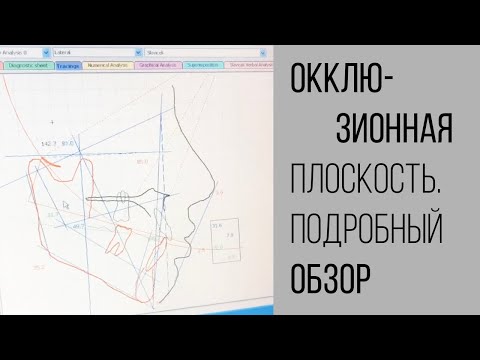 Видео: Окклюзионная плоскость. Комментарии нашего ортодонта с рисунками. Поймет даже ребёнок.