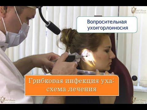 Видео: Грибковая инфекция уха: схема лечения, которая приводит к выздоровлению