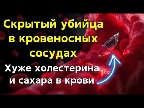 Видео: Худший яд в крови! Опаснее сахара и жира, но о нём молчат