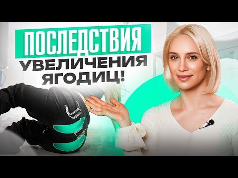 Видео: Все методы увеличения ягодиц – страшные ПОСЛЕДСТВИЯ. Мой личный кейс!