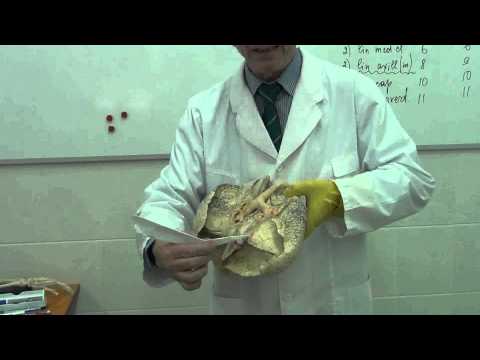 Видео: Легкие, плевра  Рисунок на доске и препараты