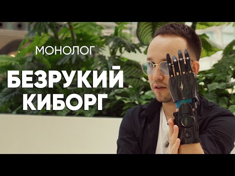 Видео: Был безрукий инвалид, а стал киборгом: #монолог человека с киберпротезом