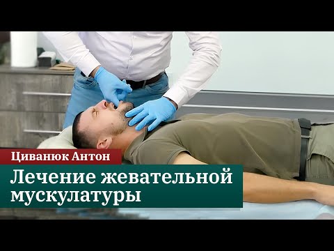 Видео: Лечение жевательной мускулатуры. Циванюк А.В.
