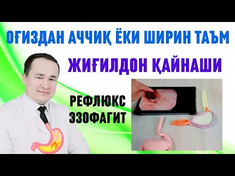 Видео: ОҒИЗГА АЧЧИҚ ТАЪМ КЕЛИШИ, ЖИҒИЛДОН ҚАЙНАШИ, РЕФЛЮКС ЭЗОФАГИТ,  САБАБИ ВА ДАВОЛАШ ТАКТИКАСИ