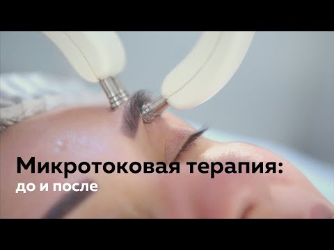 Видео: Микротоковая терапия в салоне (До и После процедуры)