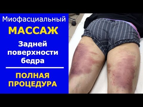Видео: Миофасциальный массаж. Задняя поверхность бедра
