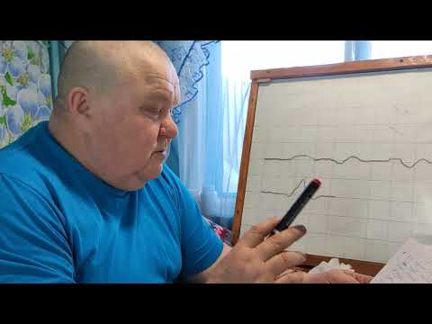 Видео: Рихтовка прямых. Рихтовка в зимнее время.