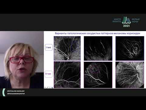 Видео: Эволюция развития сосудистой сети в опухоли. Диагностические возможности и интерпретация