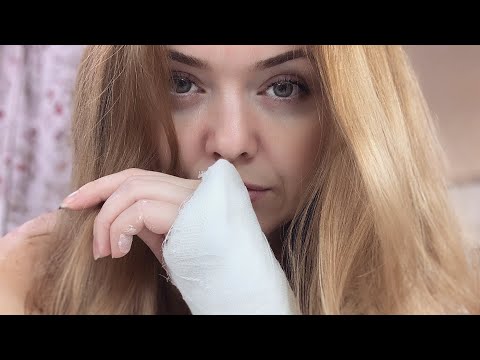 Видео: ВЛОГ Сломала руку! Перелом лучевой кости! Травматология 11-12.01.20