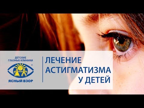 Видео: Как лечить астигматизм у детей?