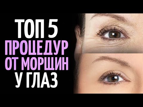 Видео: Как избавиться от морщин вокруг глаз? ТОП 5 процедур.