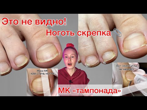 Видео: КАК ПРАВИЛЬНО СТРИЧЬ НОГТИ | НОГОТЬ-СКРЕПКА | ТАМПОНАДА ⚠️ подробно #алена_лаврентьева #nails #ногти