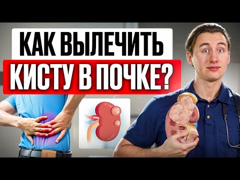 Видео: Кисты почек — ПРИГОВОР или пустяк? Что нужно срочно проверить?