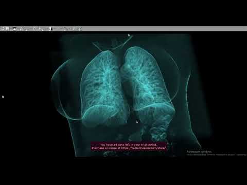 Видео: Как быстро посмотреть КТ ОГК