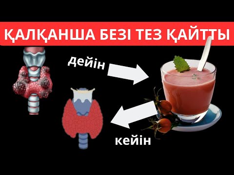 Видео: ҚАЛҚАНША БЕЗІ САҒАТ СЕКІЛДІ ЖҰМЫС ЖАСАЙТЫН БОЛАДЫ  Симптомдар мен тез орнына келтірет 4 жолы