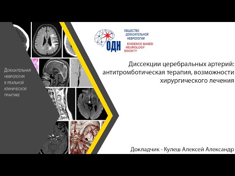 Видео: Диссекции церебральных артерий: антитромботическаятерапия, возможности хирургического лечения