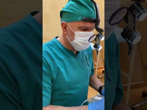 Видео: Удаление атеромы на мочке уха