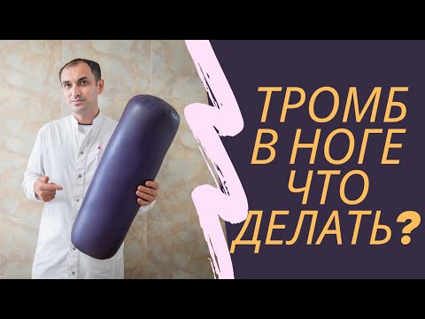 Видео: Что делать если возник тромбоз. Флеболог Москва.