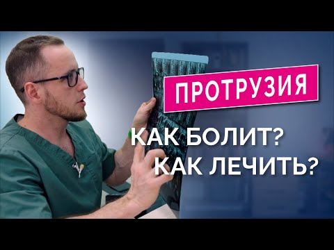 Видео: ПРОТРУЗИЯ в пояснице: как лечить? Прием пациента, разбор МРТ, тесты, лечение