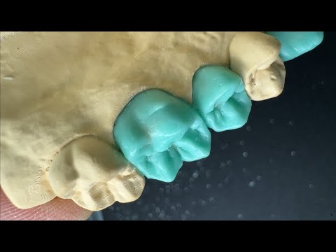 Видео: Ваксап. Верхние боковые зубы