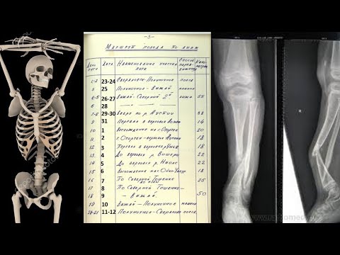 Видео: Перевал Дятлова. Особенности экспертных оценок травм и повреждений. Маршрут группы и место гибели