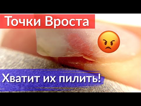 Видео: Как не пропилить ТОЧКИ ВРОСТА ногтя | Ошибки в маникюре