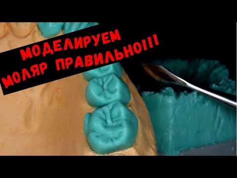 Видео: Серия видео моделировки зубов верхней челюсти. Как смоделировать зуб? Моляр, моделирование из воска.