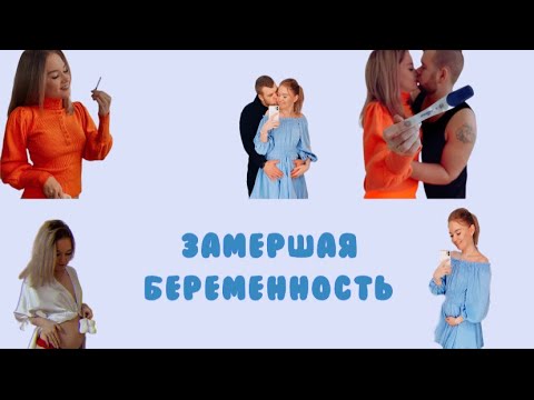 Видео: ЗАМЕРШАЯ БЕРЕМЕНОСТЬ-ЭТО СЛУЧИЛОСЬ 🤰СО МНОЙ МОЯ ИСТОРИЯ😢