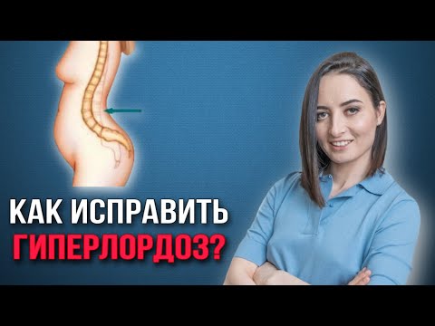 Видео: Гиперлордоз поясничного отдела | 3 упражнения, которые исправят лордоз и прогиб поясницы навсегда