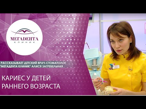 Видео: Кариес у детей раннего возраста. Рассказывает детский врач-стоматолог Алися Загребельная