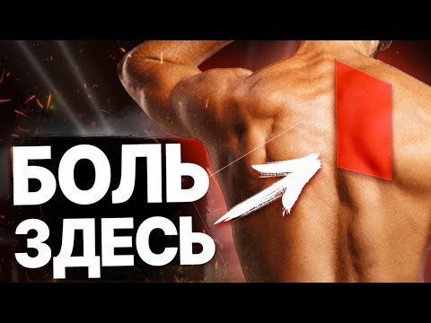 Видео: Боль в/под/между лопатками. Кол между лопаток