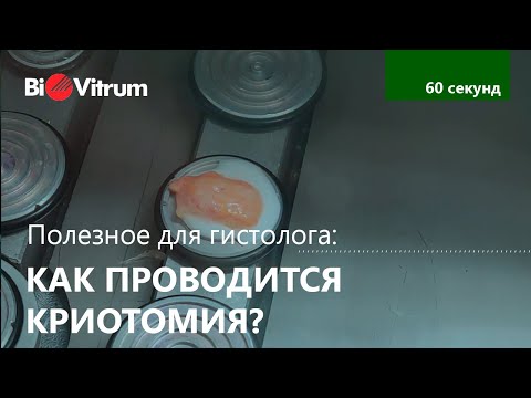 Видео: Как проводить криотомию?