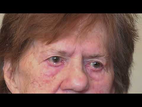 Видео: ТРОСТЕНЕЦ БАБУШКА ВЕТЕРАН