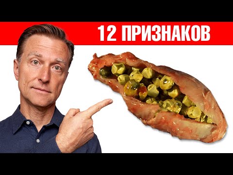 Видео: 12 симптомов того, что желчный пузырь в опасности!😲