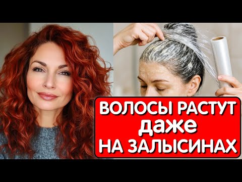 Видео: Эта МАСКА СПАСЛА ОТ ВЫПАДЕНИЯ ВОЛОС ! Нанесла это средство и мои ВОЛОСЫ РАСТУТ как сумасшедшие