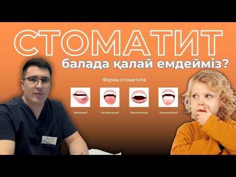 Видео: стоматит емі/ стоматит қазақша/үйде емдеу/ауыз ойылу