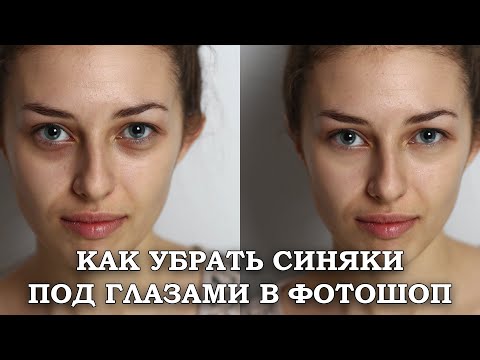 Видео: Как убрать синяки под глазами в Фотошоп [Быстрый и простой способ избавления от синяков в Photoshop]