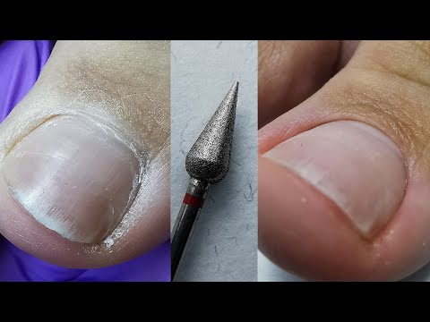 Видео: РЕКОРД ПЕДИКЮРА 42 МИНУТЫ❤️обработка пальчиков🔥новая фреза капля🙈идеальный чистый педикюр💖