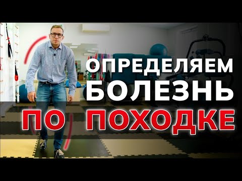 Видео: Вот что видит врач: КАК ПО ПОХОДКЕ узнать, что у вас болит