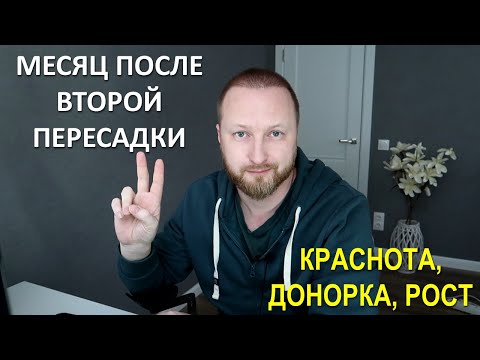 Видео: 1 МЕСЯЦ ПОСЛЕ ВТОРОЙ ПЕРЕСАДКИ ВОЛОС | FUE vs DHI |