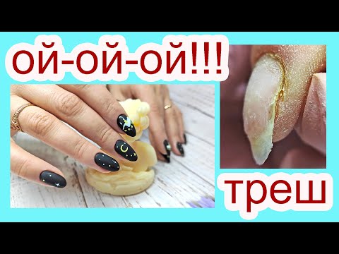 Видео: Точки вроста ПОКИНУЛИ ЧАТ🌸 сложная коррекция🌸 НА ХУТОР бабочек ловить